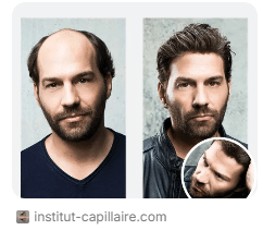 Soin capillaire