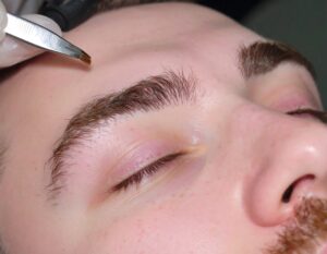 EPILATION EN INSTITUT DE BEAUTE