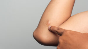 EPILATION EN INSTITUT DE BEAUTE